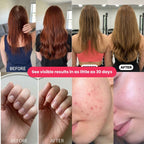 Hair, Skin & Nails Gummies